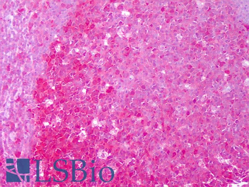 IHC-plus™ HSP90AA / HSP90 Alpha Antibody (clone Hyb-K41009)