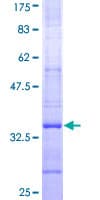 Human SYVN1 / HRD1 Protein (Recombinant GST, N-terminus)