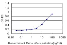 IHC-plus™ FOXO3 / FOXO3A Antibody (clone 4F2)