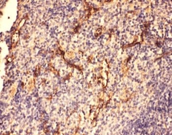 Polyclonal Rabbit anti-Rat Complement C5a Antibody (aa1-18, IHC, WB)