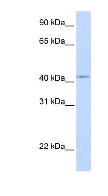 Polyclonal Rabbit anti-Human COX10 Antibody (aa180-229, WB)