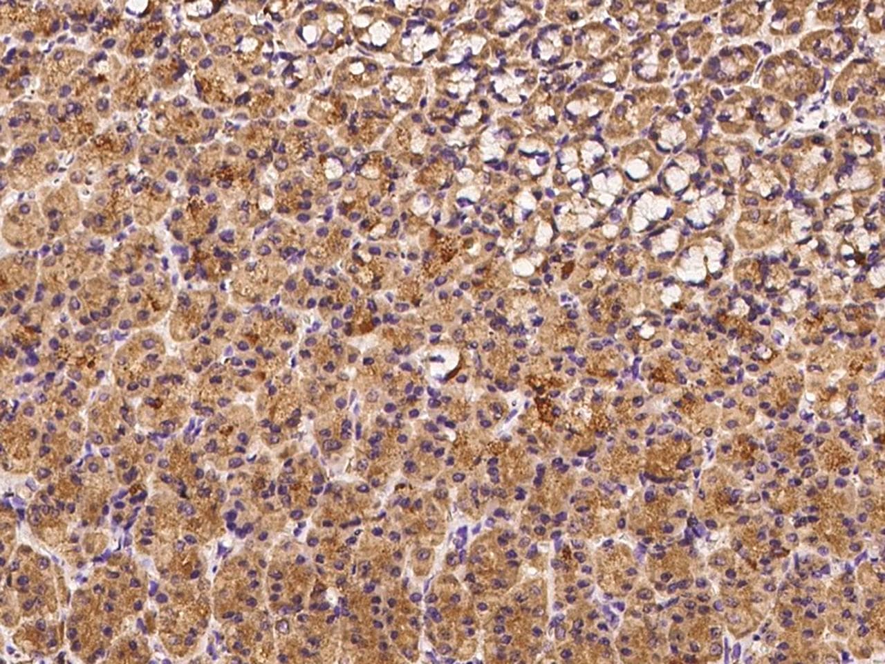 IL13RA2 / IL13R Alpha 2 Antibody (Preservative Free)