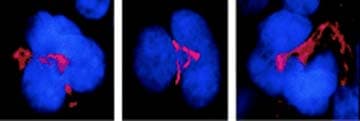 FKBP5 / FKBP51 Antibody (clone Hi51B, AP)