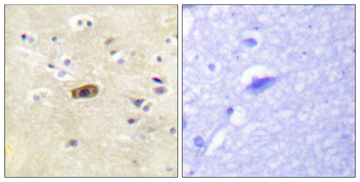 Polyclonal Rabbit anti-Human GRIN2A+GRIN2B Antibody (aa1216-1265, IHC, IF)