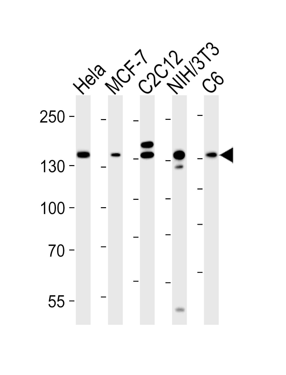 Monoclonal Mouse anti-Human Raptor / Mip1 Antibody (clone 1411CT316.2.151.34, WB)