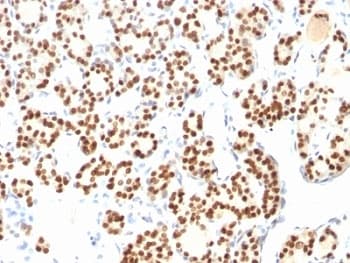NKX2-1 / Thyroid-Specific TF Antibody (clone 8G7G3/1 + NX2.1/690, Ready-to-Use)