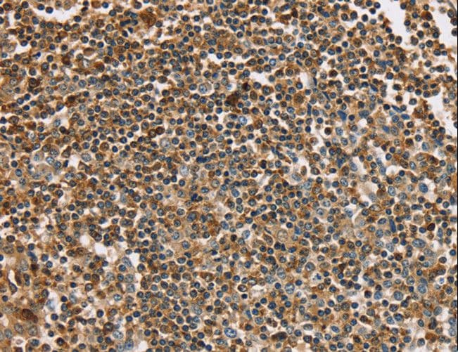 PLS3 / T Plastin Antibody