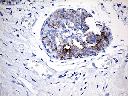TFF1 / pS2 Antibody (aa25-84, clone OTI7B12)