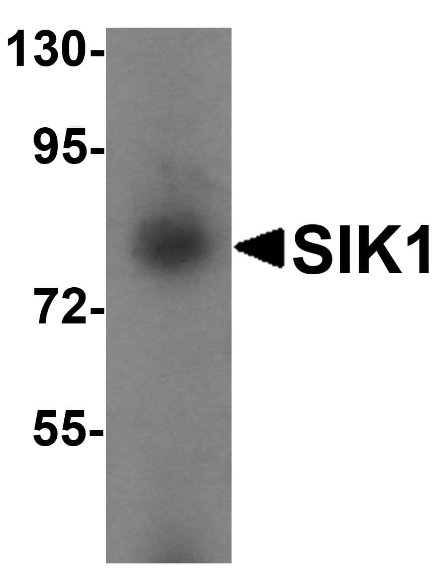IHC-plus™ SIK1 / MSK Antibody