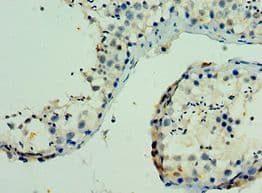 Polyclonal Rabbit anti-Human PAK6 Antibody (aa1-270, IHC)