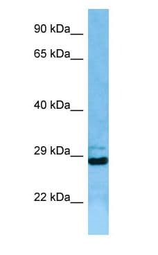 EIF3J Antibody (aa53-102)