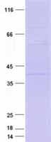 Human LOX / Lysyl Oxidase Protein (Recombinant DDK,C-terminus)