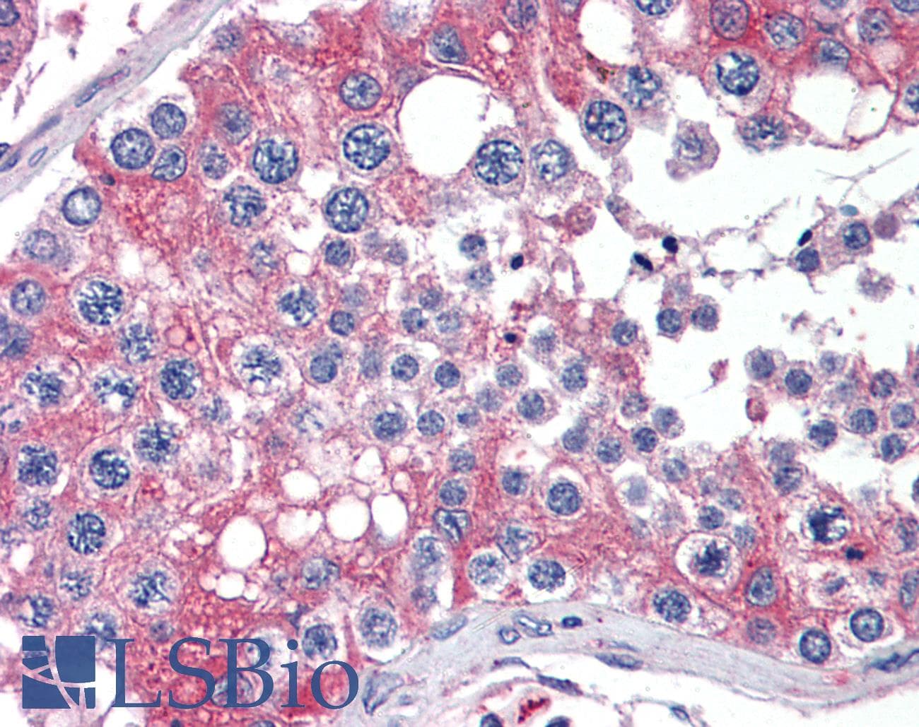 IHC-plus™ APOBEC3G / CEM15 Antibody (aa365-376)