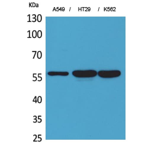 PDIA3 / ERp57 Antibody (111-160 aa, Internal)
