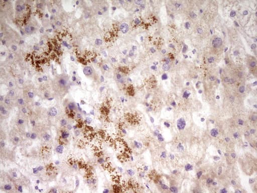 Monoclonal Mouse anti-Human PAPSS2 Antibody (clone OTI3H10, aa1-247, IHC, WB)