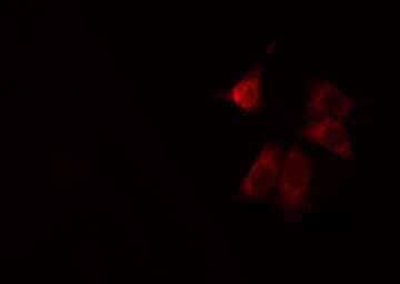 CCDC102A Antibody
