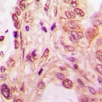 Polyclonal Rabbit anti-Human SRSF1 / SF2 Antibody (IHC, IF, WB)