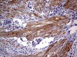 AFAP1 / AFAP Antibody (aa100-386, clone OTI2G9)