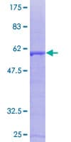 Human SDCBP / Syntenin Protein (Recombinant GST)