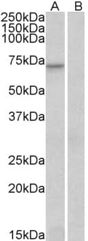 IHC-plus™ FOXO3 / FOXO3A Antibody (aa661-673)