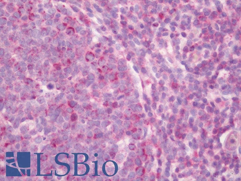 IHC-plus™ PTPN11 / SHP-2 / NS1 Antibody (aa508-557)