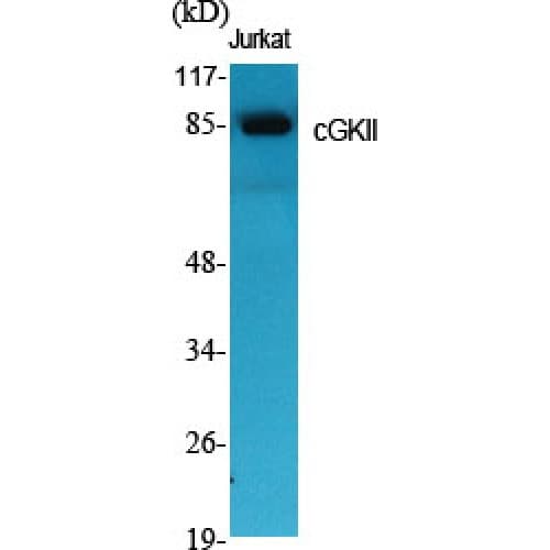 Polyclonal Rabbit anti-Human PRKG2 / CGKII Antibody (360-440 aa, Internal, IHC, WB)