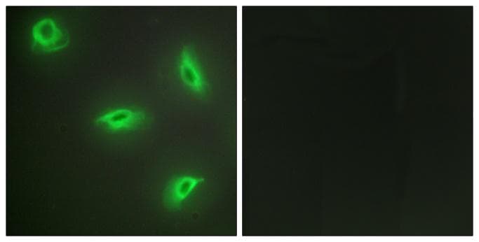 Polyclonal Rabbit anti-Human TNFSF14 / LIGHT Antibody (IF)