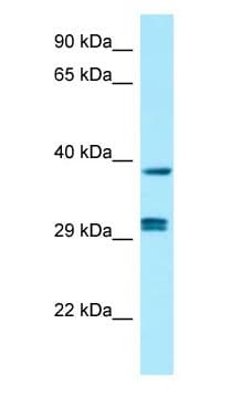 PPP1CB Antibody (aa194-243)