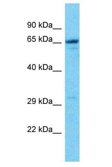 Polyclonal Rabbit anti-Human NAG20 / UBAP1 Antibody (aa381-430, WB)