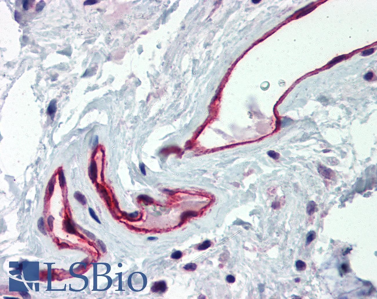 IHC-plus™ ACKR1 / DARC Antibody