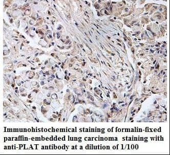 Polyclonal Rabbit anti-Human PLAT / TPA Antibody (aa87-377, IHC, WB)