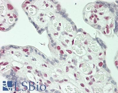 IHC-plus™ Polyclonal Rabbit anti-Human MED12 Antibody (aa2150-C-term, IHC)