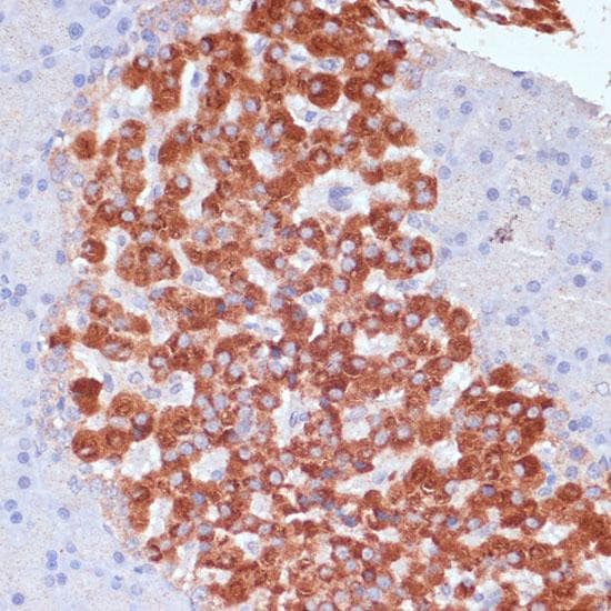 KANK2 Antibody