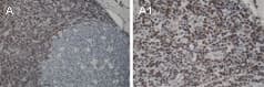 BCL2 / Bcl-2 Antibody (aa67-86)