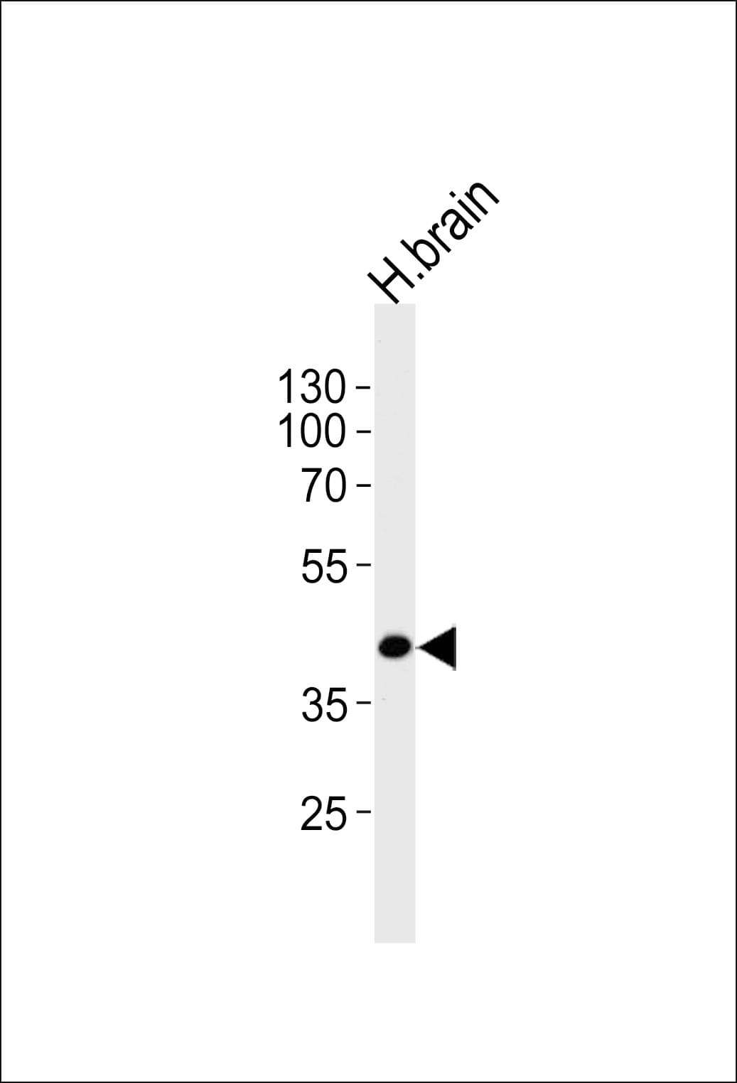 SEPT5 / Septin 5 Antibody (aa1-30)