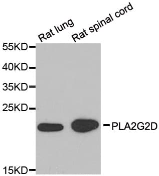 IHC-plus™ PLA2G2D Antibody