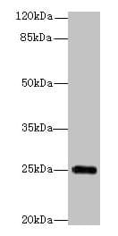 GOSR2 / Membrin Antibody (aa1-190)
