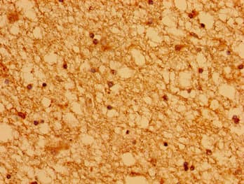 ASCL1 / MASH1 Antibody