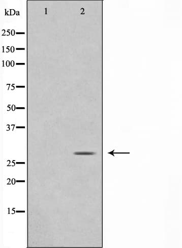 MOB4 / PHOCN Antibody