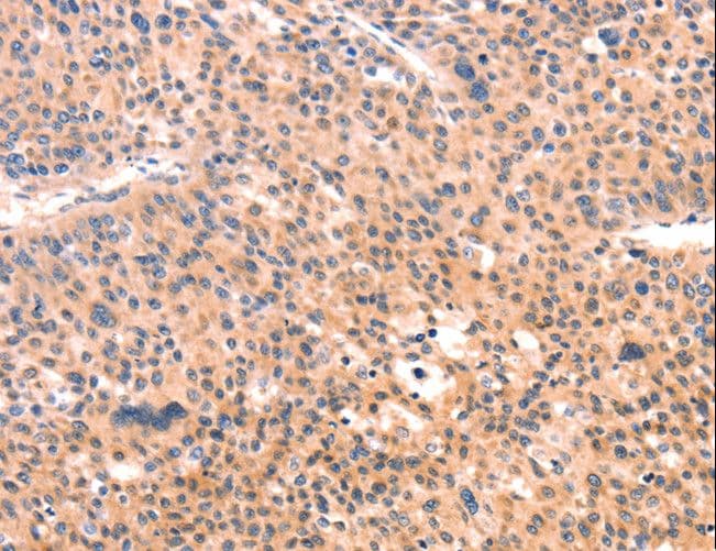 APBA2 Antibody