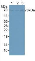 FOXO1 / FKHR Antibody (aa222-469)