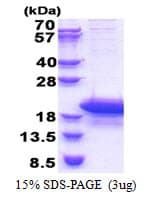 Human ARPP19 Protein (Recombinant His)