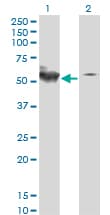 Monoclonal Mouse anti-Human STK38 Antibody (clone 2G8-1F3, IHC, IF, WB)
