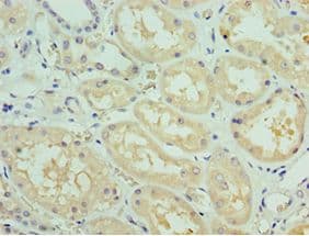 Polyclonal Rabbit anti-Human SOST / Sclerostin Antibody (aa24-213, IHC)