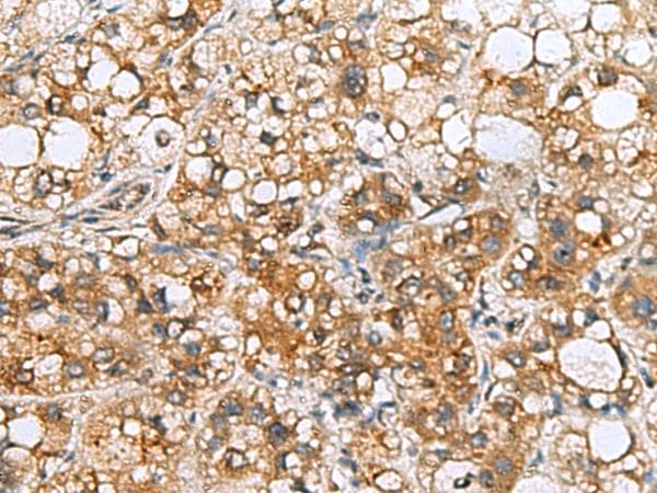 TMED10 / TMP21 Antibody