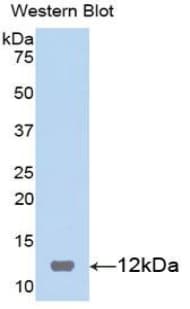 S100B / S100 Beta Antibody (aa1-92)