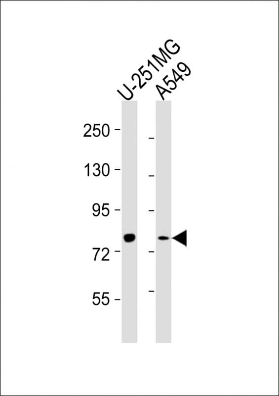 FES Antibody (clone 1467CT528.22.17)