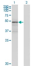 TNXB / Tenascin XB Antibody (clone 2D3-1B10)
