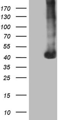 Monoclonal Mouse anti-Human PAGE1 Antibody (clone OTI4E6, WB)