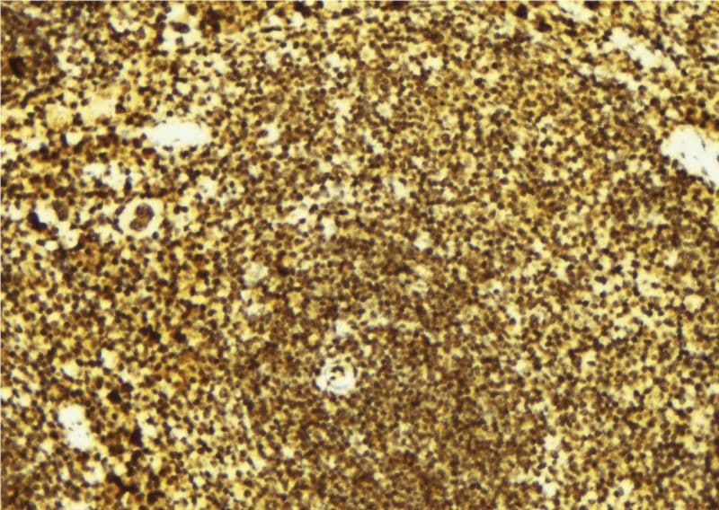 CTDSP1 / SCP1 Antibody